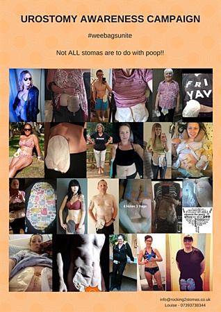 Urostomy Awareness Campaign