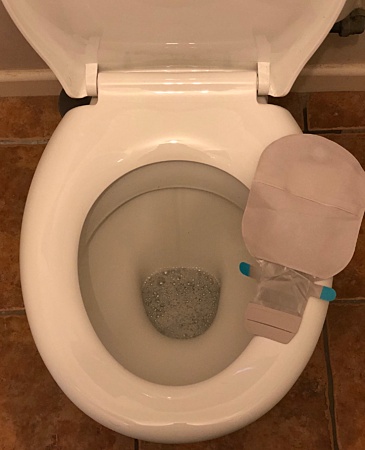 How To Empty A Colostomy Bag Fast And Without Any Mess